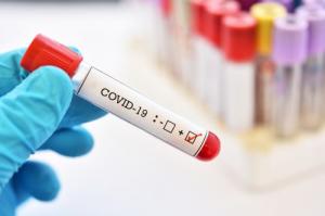 22 إصابة جديدة بفيروس كورونا
